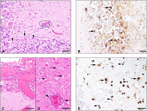 Figure 1. Histopathology and immunohistochemical findings in the brain tissue of the seals. The cerebellum of the H5N1 infected seal from The Netherlands (case 1) showed the following changes: (A) An acute non-suppurative and necrotising encephalitis with mild perivascular lympho-histiocytic infiltration (circle), diffuse gliosis of the adjacent neuroparenchyma (molecular layer), necrosis of Purkinje cells (arrow) and necrosis of inner granular cells (arrowheads); (B) Abundant intralesional AIV nucleoprotein in cells of the inner granular layer (arrowheads) and within the adjacent neuropil. The brain of the H5N1 infected seal from Germany (case 2) showed: (C) Moderate lympho-histiocytic leptomeningitis. (D) Moderate non-suppurative and necrotising encephalitis with perivascular lympho-histiocytic cuffing and vasculitis (arrows), gliosis and necrosis (arrowheads) in the adjacent parenchyma. E. Abundant AIV nucleoprotein in neuronal nuclei, perikarya and processes (arrows) and in various glial cells (arrowheads) of the cerebrum.