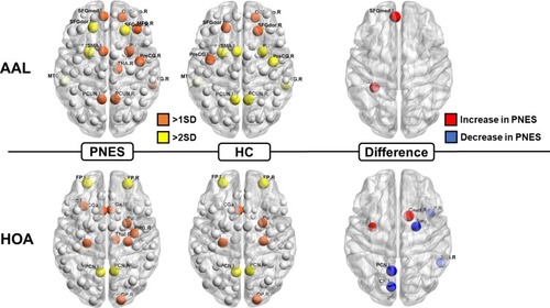 Figure 3 Locations of nodal betweenness centrality in the two groups (left and center) and significantly different nodes (right). The size of the node denotes the betweenness centrality in each group (left and center) and the t-values of the differences (right). The node abbreviations correspond to those of Supplementary Tables 1 and 2.