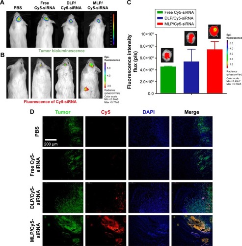 Figure 10 Living imaging of C6-GFP-luci tumor–bearing mice 4 h after DLP/Cy5-siRNA, MLP/Cy5-siRNA, and free Cy5-siRNA were intravenously injected.Notes: (A) Bioluminescence of luciferase-expressing tumor cells 10 min following intraperitoneal injection of luciferin solution. (B) In vivo imaging fluorescence signal of Cy5-labeled siRNA. (C) Ex vivo imaging brain fluorescence signal of Cy5-labeled siRNA. (D) Fluorescent microscope images show the distribution of Cy5-siRNAs in glioma following intravenous injection of free Cy5-siRNAs and MLP/Cy5-siRNAs. Cy5-siRNAs (red), tumor (green), and cell nuclei are stained with 4′,6-diamidino-2-phenylindole (blue). Scale bar =200 μm.Abbreviations: DLP, Bis(palmitoyloxy)-3-(dimethylamino)propane liposomes; MLP, O′1,O1-(3-(dimethylamino)propane-1,2-diyl) 16-bis(2-(2-methyl-5-nitro-1H-imidazol-1-yl)ethyl) di(hexadecanedioate) liposomes; PBS, phosphate-buffered saline; siRNA, small interference RNA.