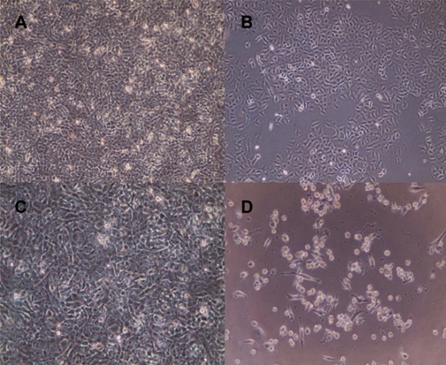 Figure 8 MCF7 cell lines treated with different formulations: control cells (A); ferulic acid, 250 µM (B); nanosponges, 250 µM (C); ferulic acid-loaded nanosponges, 250 µM (D). Microscopic magnification ×10 K, after 24 hrs of incubation.