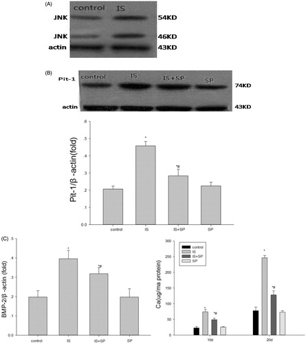 Figure 4. The role of the JNK pathway in the upregulation of Pit-1 expression induced by IS. (A) The activation of JNK by 500 μM IS. (B) The JNK inhibitor, SP600125 (SP; 20 μM), partly suppressed the effect of IS on stimulation of Pit-1 expression. (C) SP partially suppressed the effect of IS on stimulation of BMP-2 expression and calcium content. Results are presented as percentage of control values and are mean ± SD of three independent experiments. *p < 0.05, compared with the control group. #p < 0.05, compared with the IS-stimulated group.