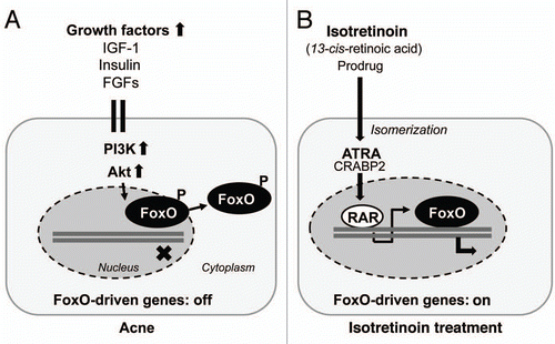 Figure 1 (A) Nuclear exclusion of FoxO proteins into the cytoplasm by growth factor signaling due to Akt kinase-mediated phosphorylation of nuclear FoxO proteins. (B) Isotretinoin-mediated upregulation of FoxO expression as a secondary response of proapoptotic RAR-signaling. FoxO-regulated genes are switched on. IGF-1, insulin-like growth factor-1; FGFs, fibroblast growth factors; PI3K, phosphoinositol-3 kinase; Akt, Akt kinase (protein kinase B); FoxO, forkhead box class O transcription factor; ATRA, all-trans-retinoic acid; CRABP2, cellular retinoic acid binding protein-2; RAR, retinoic acid receptor.