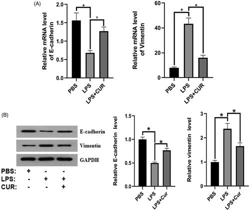 Figure 2. The effect of curcumin on the expression of E-cadherin and vimentin in the LPS-induced BPH mouse model (n = 8). (A,B) Protein and mRNA expression of E-cadherin and vimentin. *p < 0.05.