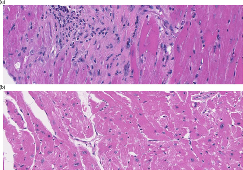 Fig. 1 Hematoxylin- and eosin-stained heart tissue shows striking histological changes in 32-month-old CB6F1 male mice (a) compared with strain and gender-matched 8-month-old mice (b). The heart section from the old mouse shows an increased cellular infiltrate indicative of localized reactive sites, and extensive areas of fibrosis. These lesions help explain the cardiac dysfunction and increased heart weight observed in the older-aged mice.