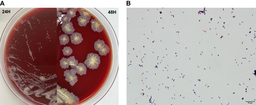 Figure 1 Colonial appearance and gram staining of T. inchonensis. (A) Colonial appearance of T. inchonensis on a Columbia blood agar plate after 24h and 48h of incubation; (B) Gram staining (bioMérieux, SA) of T. inchonensis isolated from peritoneal dialysate cultures (×1000).