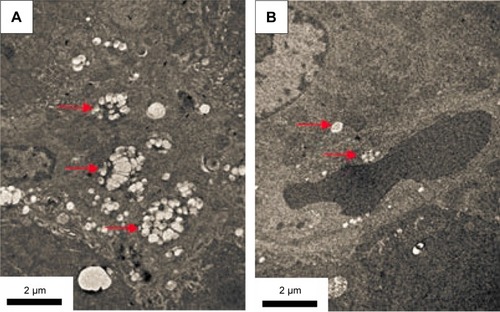 Figure 10 Bio-TEM images of (A) KCs and (B) vascular endothelial cells in liver tissues selected from a mouse after treatment with PEI@PMMA/miRNA NPs.Note: The red arrows indicate the location of PEI@PMMA NPs in liver tissues.Abbreviations: KCs, Kupffer cells; NPs, nanoparticles; PEI, polyethyleneimine; PMMA, poly(methyl methacrylate); TEM, transmission electron microscopy.