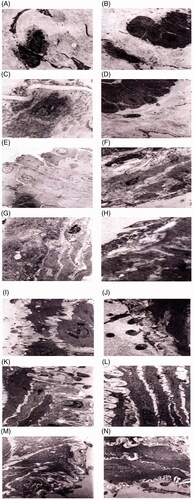 Figure 9. Morphological electron microscopy images of the portal vein. (A, B) Blank control group; (C, D) Sham operation group; (E, F) Model group; (G, H) Low-dose Octreotide microsphere injection group; (I, J) Medium-dose Octreotide microsphere injection group; (K, L) High-dose Octreotide microsphere injection group; and (M, N) Sandostatin injection group.