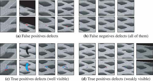 Figure 7. Examples of image patches of data set A (upper row) with merged predictions (lower row). At pixel level, blue pixels indicate true positive predictions, red pixels indicate false positives and purple pixels indicate false negatives. The contrast of undetected defects in (a) resembles the contrast of false positively detected structures in (b). This is a consequence of the problem that no sharp line between a defect and non-defect can be drawn.