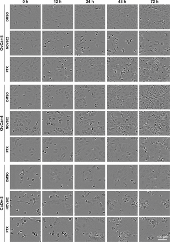 Figure S1 Cell population growth suppression by NOV202 and PTX in OC cell lines in vitro.