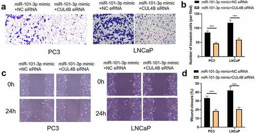 Figure 13. Inhibition of CUL4B further enhances the inhibitory effect of up-regulated miR-101-3p on PCA cell migration and invasion. (a–b) The wound-healing experiments observed cellular migration in different groups. The closure rates (%) in scratch areas from different groups of LNCaP and PC3 cells were compared. (c–d) Transwell invasion experiments were used to observe invasion ability in LNCaP cells and PC3 cells. ***P < 0.001