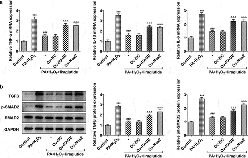 Figure 5. Effect of liraglutide treatment in inflammatory factor and TGFβ/SMAD. (a) The mRNA levels of TNF-α, IL-1β and IL-6. (b) The protein levels of TGF and SMAD2. Values are indicated as mean ± SD. ***P < 0.001 compared with Control. ### P < 0.001 compared with PA+ H2O2 group. ΔΔΔP < 0.001 compared with Ov-NC group.