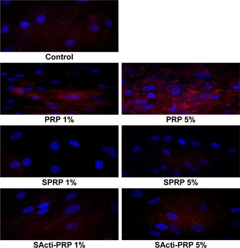 Figure 3 The effect of different concentrations of PRP, SPRP, and SActi-PRP on expression of β1-integrin receptor in human skin fibroblasts.