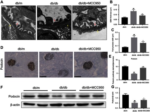 Figure 2 MCC950 attenuated podocyte injury in db/db mice.