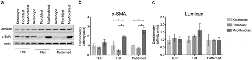 Figure 4. Protein expression of keratocyte markers. The expression levels of α-SMA and Lumican were normalized to Actin (a). α-SMA (b) and Lumican (c) expressions were compared between different phenotypes. The results are shown as average ± SD from three biological replicates. * P < 0.05.