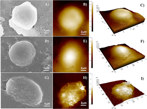 Figure 13 SEM images, AFM images and 3D reconstruction of a representative untreated MDA-MB-231 cell used as control sample (A–C); a representative cell treated with the NF platform without Dox (D–F); and a representative cell treated with the NF platform with Dox (G-I).