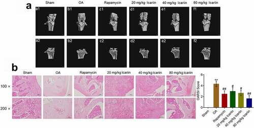 Figure 5. Icariin markedly ameliorated the pathological state of cartilage tissues in OA rats. (a). Pathological changes of articular cartilage were visualized using micro-CT scanning. The rough surface, focal plane cracks, exposed subchondral bone, oval osteophytes in articular cartilage and thin cartilage layer, disordered arrangement of bone trabeculae, and cystic subchondral bone on articular head were significantly alleviated in the rapamycin and icariin groups. (b). Pathological state of cartilage tissues was evaluated using safranin O staining. Cartilage degeneration and loss of proteoglycan, surface layer, and fiber layer in OA rats were notably ameliorated in the rapamycin and icariin groups