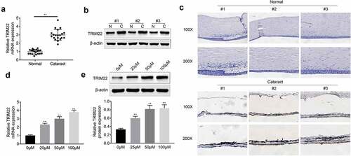 Figure 1. The expression of TRIM22 was promoted in cataract tissues. (a, b) The expression of TRIM22 in cataract tissues was detected with the RT-PCR and western blotting. (c) Immunohistochemical staining was performed for the detection of the expression of TRIM22 in cataract tissues. (d, e) The expression of TRIM22 in lens epithelial cells was detected with the RT-PCR and western blotting. ** p < 0.01 (Control vs H2O2)