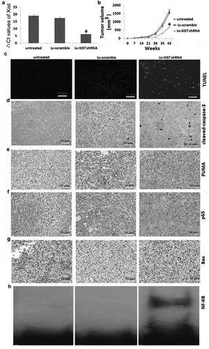 Figure 4. Targeting XIST inhibits osteosarcoma growth in in Vivo, and increases NF-KB activity, P65 nucleus translocation and PUMA expression. (A) Nude mice received subcutaneous injection of U2OS cells for 7 weeks, relative expression of XIST in U2OS cells was detected by qRT-PCR. (B) Tumor growth curve after nude mice received subcutaneous injection of U2OS cells for 7 weeks. (C) Cell apoptosis by TUNEL assay; Expression of cleaved-caspase-3 (D), PUMA (E), P65 (F), bax (G) in tumors using immunohistochemical staining; H, NF-kB assay was detected by EMSA. aP<0.01.