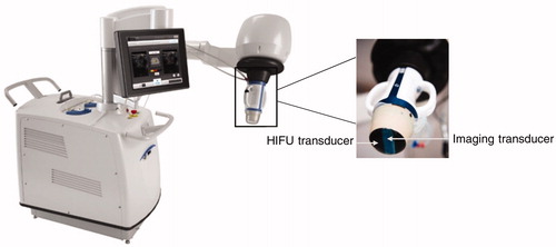 Figure 1. Echopulse ® HIFU device.
