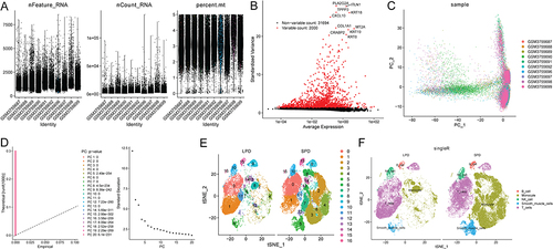 Figure 5 Identification of monocytes marker genes. (A) 66,350 cells were used for analysis; (B) highly variable genes in the variance analysis; (C) PCA; (D) analysis of top 20 principal components; (E) 17 independent clusters of peritoneal cells; (F) annotation of clusters.