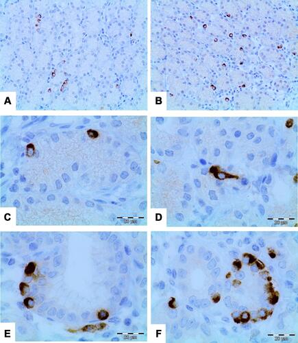 Figure 1 Immunohistochemical study for gastric ghrelin. Typical immunohistochemical characteristic showing cells located in the gastric glandular basal region with irregular distribution (A) and showing cells intermixed with mucous glands individually, some cluster of ghrelin cells are present (B). Characteristic immunoreactivity of ghrelin cells with granular cytoplasmic reactivity and cubic morphology (C). Fusiform morphology occasionally evidenced in ghrelin cells with characteristic granular cytoplasmic reactivity (D). (E) Positive ghrelin cells and presence of intestinal metaplasia. Note the absence of positive ghrelin cells in metaplasia intestinal metaplasia. (F) Ghrelin cells distributed in groups of 3 to 8 cells. This finding was the least evidenced in the study. (Direct increase 10X to 60X).