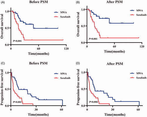 Figure 3. Kaplan-Meier curves of overall-all survival (OS) and progression-free survival (PFS) in patents who took Sorafenib or accepted microwave ablation (MWA) before one-to-one PSM (Sorafenib-group: n = 22; the median OS, 16.6 months; 95% CI: 13.4–19.8 months). MWA-group: n = 30; the median OS, 48.8 months; 95% CI: not available. p = .001) (A) and (Sorafenib-group: n = 22; the median PFS, 2.8 months; 95% CI: 1.2–4.4 months. MWA group: n = 30; the median PFS, 9.3 months; 95% CI: 0.0–27.2 months. p = .001) (C), respectively. After one-to-one PSM, Kaplan-Meier curves of overall-all survival (OS) and progression-free survival (PFS) in patents who took Sorafenib or accepted microwave ablation (MWA) (Sorafenib-group: n = 22; the median OS, 16.6 months; 95% CI: 13.4–19.8 months. MWA-group: n = 22; the median OS, Not reached; 95% CI: not available. p = .001) (B) and (Sorafenib group: n = 22; the median PFS, 2.8 months; 95% CI: 1.2–4.4 months. MWA group: n = 22; the median PFS, 9.0 months; 95% CI: 6.6–11.4 months. p = .006) (D), respectively.