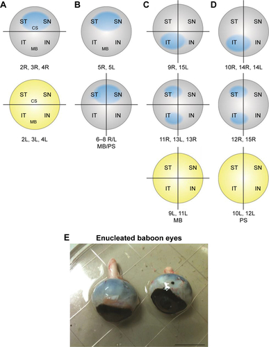 Figure S1 Diagram of injection and collection paradigms for subretinally injected eyes.Notes: Blue in each diagram represents approximate region of subretinally injected eyes. Intravitreally injected eyes are colored yellow to indicate presumptive diffusion of material throughout the vitreous. Lines indicate approximately how eyes were dissected. Numbers below illustrations correspond with individual animals enrolled in this study. (A) Eyes injected with saline or CBA-GFP. (B) Eyes injected with VMD2-GFP (divided into quadrants except for 5L and 5R which were collected as bulk tissue). (C) Eyes injected with RK-GFP and processed for molecular biology (divided into quadrants). (D) Eyes injected with RK-GFP and processed for sectioning along the inferior–superior plane as indicated by the line. (E) Photograph of enucleated baboon eyes; scale bar is 2 cm.Abbreviations: CS, tissue collected for cryosectioning; IN, inferior nasal; IT, inferior temporal; MB, tissue collected for molecular biology/protein chemistry; PS, tissue collected for paraffin sectioning; SN, superior nasal; ST, superior temporal.