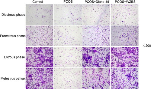 Figure 2. WZBS recipe normalized the estrous cycle of LE-induced PCOS rats. All the pictures were original magnification ×200. n = 3.