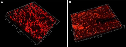 Figure 2 Volumetric reconstruction of marker expression of procollagen (CLSM).