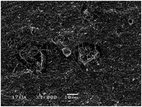 Figure 4. SEM micrograph revealed pores in specimens of group Z-3. Magnification 1000×.