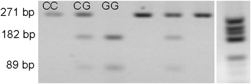 Figure 1.  The PCR-RFLP products for HSL C-60G polymorphism on agarose 2%. The size of products were determined in comparison with Roche DNA molecular marker V. Homozygote CC 271 bp, homozygote GG 182 and 89 bp, and heterozygote CG 271, 182, and 89 bp.