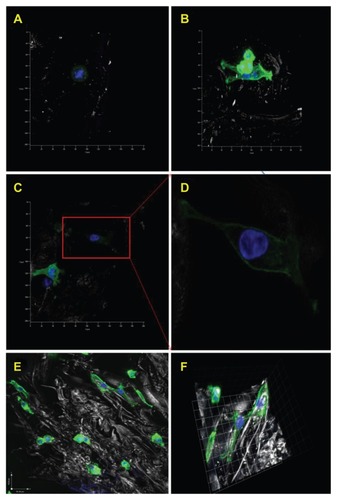 Figure 12 Confocal microscopy images of human osteoblasts on various chitosan scaffolds after one day proliferation. Typical cell morphologies on (A) chitosan controls; (B) 20% nHA in chitosan scaffolds; (C) 20% nHA + B-SWCNT in chitosan scaffolds and (D) enlarged cell morphology in image (C) which shows extended cell spreading on the novel biomimetic bone scaffold. In addition, (E) shows lower magnification confocal microscopy images of osteoblasts attached on10% nHA chitosan scaffold and (F) shows 3-D morphology of attached cells.Note: Blue represents nuclei stained by DAPI; green represents cytoskeleton stained by rhodamine-phalloidin.