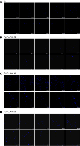 Figure S6 Confocal analysis showing presence of KG1a cells at different depths of the scaffold. Slices (10 μm) of the composite image shown in Figure S5 following confocal imaging with 4′,6-diamidino-2-phenylindole (DAPI) of KG1a cells adhered to the fibronectin-coated different scaffold composites (A–G), following 2 hours’ incubation.Abbreviations: PLLA, poly-l-lactic acid; PU, polyurethane.