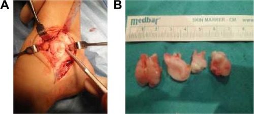 Figure 2 Intraoperative view of patient.