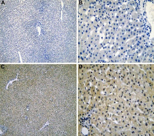 Figure 1 The IHC of normal liver tissues.