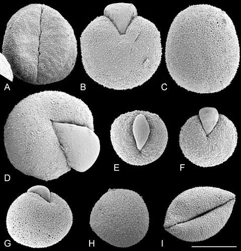 Figure 4. SEM, pollen grains of dioecious species ofTrithuria from south‐west Western Australia. A–D. T. austinensis: (A) Keighery & Gibson s.n.; (B–D) Macfarlane 4163 & Hearn. E–I. T. occidentalis: (E–H) Macfarlane 4141 & Tuckett; (I) Morrison s.n., 22 Nov. 1899. Scale bar common to all images – 10 µm.