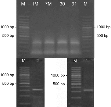 Figure 7. PCR-amplification of streptomycetes DNA for the gene involved in the synthesis of polyene antibiotics. M- DNA Ladder (Fermentas); the number of each lane corresponds to the numbers of the strains.