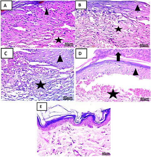 Figure 15 Photomicrographs of skin sections treatment on the 14th day in each group (H & E x 400): (A) showing fibrous connective tissue formation with hemorrhage (star) covered by scab (arrowhead).). (B) showing well-organized fibrous connective tissue with infiltration by mononuclear inflammatory cells (star) covered by some epidermal layer (arrowhead). (C) showing well-organized fibrous connective tissue with hemorrhage (star) with the partial formation of the epidermis (arrowhead). (D) showing fibrous connective tissue formation with hemorrhage (star) and epidermal layer formation (arrow) head) under scab (arrow). (E) showing the formation of well-organized fibrous connective tissue covered by the epidermis.