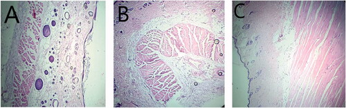 Figure 9. Skin photomicrographs (magnification 40x) of histopathological samples of (A) control Group 1 (B) nanoemulsion treated Group 2, and (C) conventional cream (Lamisil) treated Group 3.
