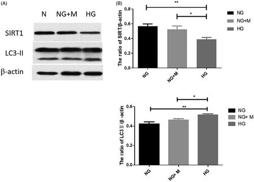 Figure 4. Expression of SIRT1 and LC3-II in immortalized mouse podocytes under normal glucose (NG), high glucose (HG), and mannitol isotonic (NG + M) conditions. (A) Representative western blotting bands corresponding to SIRT1, LC3-II, and β-actin. The expression trend of LC3II is indicated by the lower one of two bands in Western Blot, the upper band demonstrates the expression of LC3I. (B) Quantification of SIRT1 expression; (C) Quantification of LC3-II expression. Values are presented as the mean ± SD. n = 3. *p < 0.05; **p < 0.01.