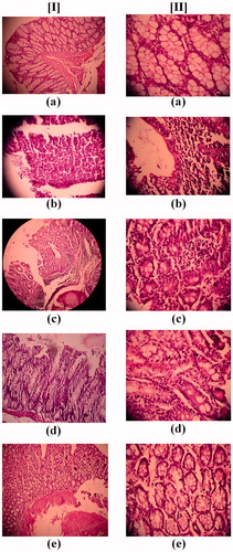 Figure 9. Representative figures of histopathology of the colon tissue after hematoxylin and eosin staining from (a) normal control rats, (b) disease control rats, (c) diseased treated with drug suspension, (d) disease treated with enteric-coated pellets containing BDS-NLCs, and (e) disease treated with enteric-coated pellets containing mannosylated NLCs; at [I] 100× magnification and [II] 400× magnification.