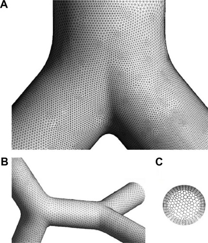 Figure 6 Visual appearance of the computer mesh used for the CFD calculation.