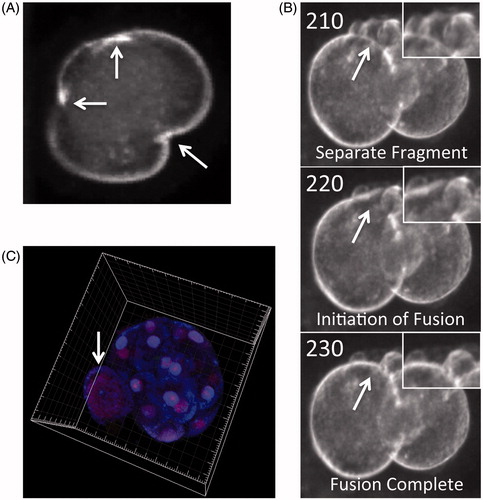 Figure 3. Potential mechanisms of aneuploidy resolution during embryo pre-implantation development. (A) Time-lapse image showing a human zygote with three cleavage furrows as it divides directly from 1-cell to 3-cells. (B) Individual imaging frames of a human embryo with cellular fragmentation demonstrating blastomeric resorption of a fragment. Adapted from Chavez et al. [Citation2012]. (C) Multi-channel confocal analysis of histone modifications in a human morula that is undergoing cavitation to form a blastocyst reveals the presence of a large and likely polyploid blastomere excluded from the embryo. Adapted from Chavez et al. [Citation2014].