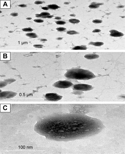 Figure 4 Transmission electron micrographs of the OIG formula at different magnifications.Abbreviation: OIG, optimized in situ gel.