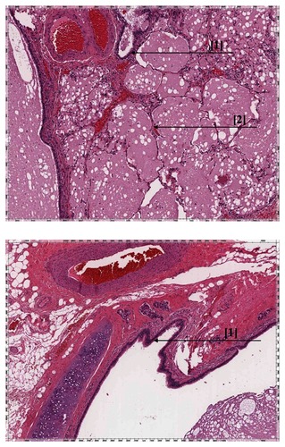 Figure 2 A) Histology specimen consisting of bronchioles (1) lined by ciliated columnar epithelium and alveoli (2). B) Histology specimen consisting of a bronchiole (1) lined by ciliated columnar epithelium.