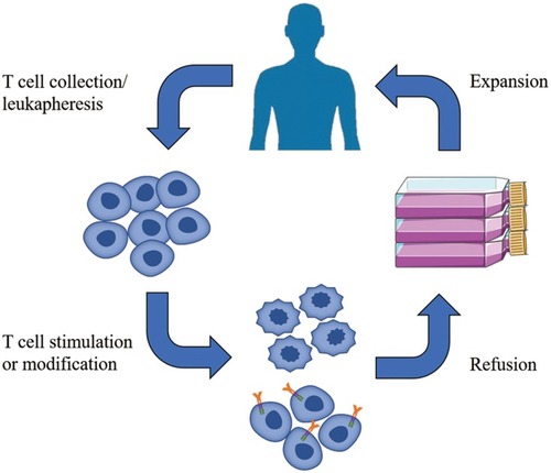 Figure 1 Adoptive cell immunotherapy (ACT) approaches: After obtaining immune cells from the patient, leukapheresis is performed. Immune cells are activated after stimulation or genetical modification. Effective immune cells are expanded and then refused to the patient.