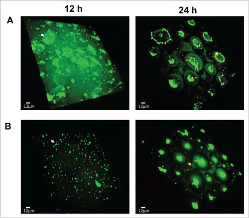 Figure 2. Confocal microscopy of C. jejuni biofilms under aerobic conditions in the absence (A) and presence (B) of an antioxidant. Biofilms were stained with SYTO9 and propidium iodine (Life Technologies) for live (i.e., green) and dead (i.e., red) cells, respectively. N-acetylcysteine was used at 1 nM for the biofilm samples in panel B. C. jejuni developed mature biofilms under aerobic conditions. An antioxidant treatment delayed biofilm formation under aerobic conditions in C. jejuni. Microcolonies were observed in 12 h, and mature biofilms were developed in 24 h. Exemplary microcolonies and dispersed cells are indicated with white and yellow arrows, respectively. The biofilms were detected with an Olympus IX-81 motorized microscope base system. The experiment was repeated 3 times, and similar results were observed in all the experiments.