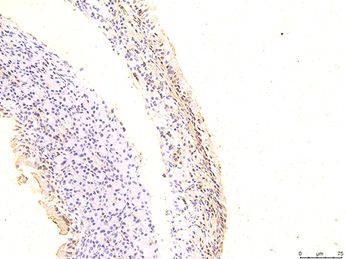 Figure 12 The immunohistochemical staining results of the day 27 group were observed under 200X microscope.