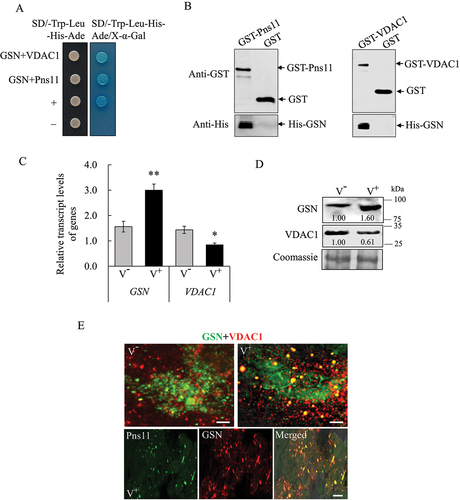 Figure 6. Interaction of GSN with Pns11 and VDAC1 in vitro and in vivo. (A) Y2H assays showing the interaction of GSN with Pns11 or VDAC1. Transformants on the SD/-Trp-Leu-Ade-His plates were labeled as follows: GSN+VDAC1, pGBKT7-GSN/pGADT7-VDAC1; GSN+Pns11, pGBKT7-GSN/pGADT7-Pns11; +, positive control, (pGBKT7-53/pGADT7-T) and –, negative control (pGBKT7-Lam/pGADT7-T). The yeast colonies were grown in SD/-Trp-Leu-His-Ade medium and were blue as shown in the β-galactosidase assay. (B) GST affinity-isolation assays showing the interaction of GSN with Pns11 or VDAC1. Pns11 or VDAC1 fused with GST represent the bait; GST represents the control, and GSN fused with His represents the prey. The baits or the GST control were incubated with cell lysate that expressed His-fused protein. Input and affinity-isolation samples were detected using antibodies against GST or His by western blot assays. (C, D) Effect of RGDV infection on the levels of expression of GSN and VDAC1 at 6-day padp as determined by RT-qPCR and western blot assays. The RT-qPCR assay shows the levels of expression of mRNA of GSN in nonviruliferous or viruliferous leafhoppers. The data are expressed as the means ± SD from 30 leafhoppers in RT-qPCR assays. The levels of expression were normalized against that of the EEF1A1/EF-1α transcript. The levels of transcripts tested in random nonviruliferous leafhoppers were normalized to 1. The levels of expression of GSN and VDAC1 in nonviruliferous or viruliferous leafhoppers were determined by western blot assays. The relative intensities of bands for these proteins are shown below. Equal amounts of protein were loaded on the Coomassie Brilliant Blue-stained gels. The data are representative of three biological replicates. V−, nonviruliferous leafhoppers. V+, viruliferous leafhoppers. *P < 0.05, **P < 0.01. (E) Immunofluorescence microscopy that shows the colocalization of Pns11, GSN and VDAC1 in the midgut epithelial cells of viruliferous leafhoppers in 12-day padp. The intestinal tissues of leafhoppers were fixed and immunostained with GSN- or Pns11-FITC (green), and VDAC1- or GSN-rhodamine (red). Bars: 5 μm.