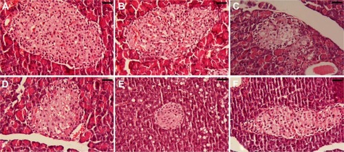 Figure 9 Histology of the pancreas.Notes: (A) Control group, showing normal cells in the islet of Langerhans. (B) SeNP-treated group, showing normal cells in the islet of Langerhans. (C) STZ group, shrunken islets of Langerhans displaying degenerative and necrotic changes in diabetic rats, in addition, there are delicate collagen fibers around the islets of Langerhans. (D) STZ-SeNP-treated group, SeNPs protected the majority of cells in the islet of Langerhans. (E) STZ-Ins-treated group, insulin protected the majority of cells in the islet of Langerhans; however, the diameter of the islet of Langerhans is small. (F) STZ-SeNPs-Ins-treated group, SeNPs and insulin protected the majority of cells in the islet of Langerhans. Sections stained with hematoxylin and eosin. Scale bar =50 μm.Abbreviations: Ins, insulin; SeNPs, selenium nanoparticles; STZ, streptozotocin.